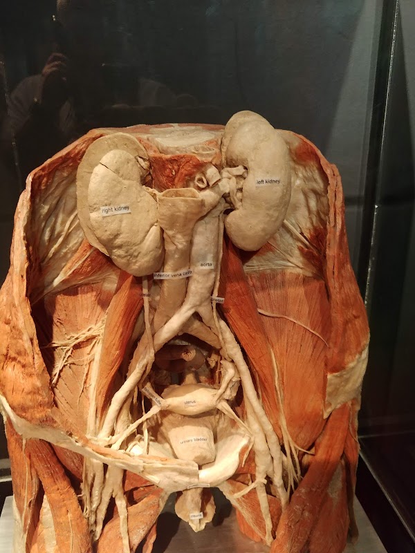 BODY WORLDS Amsterdam 5