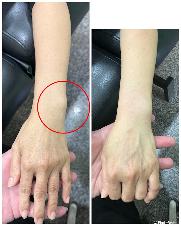 台南國術館-國家考試合格-汪鴻彰傳統整復推拿技術士-客製化足弓鞋墊-頸椎枕頭-布萊恩紅茶旁 4