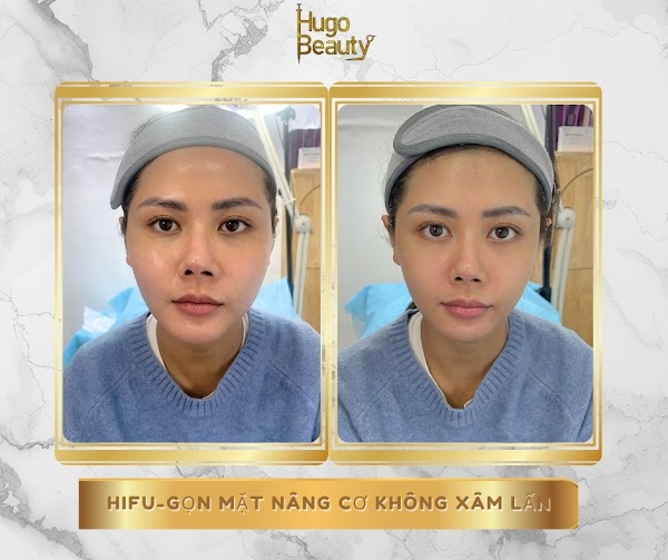 Hugo Beauty 5