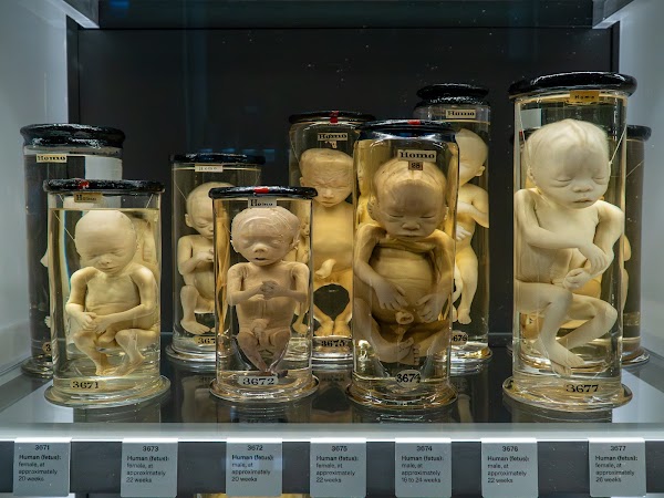 Hunterian Museum 5
