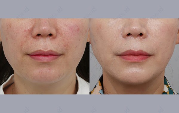 Seoul Cosmetic Surgery 5