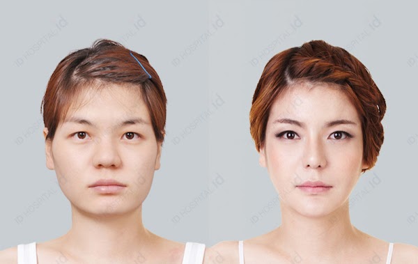 Seoul Cosmetic Surgery 4