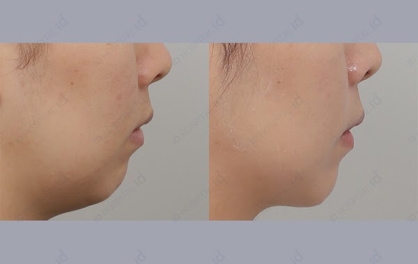 Seoul Cosmetic Surgery 3