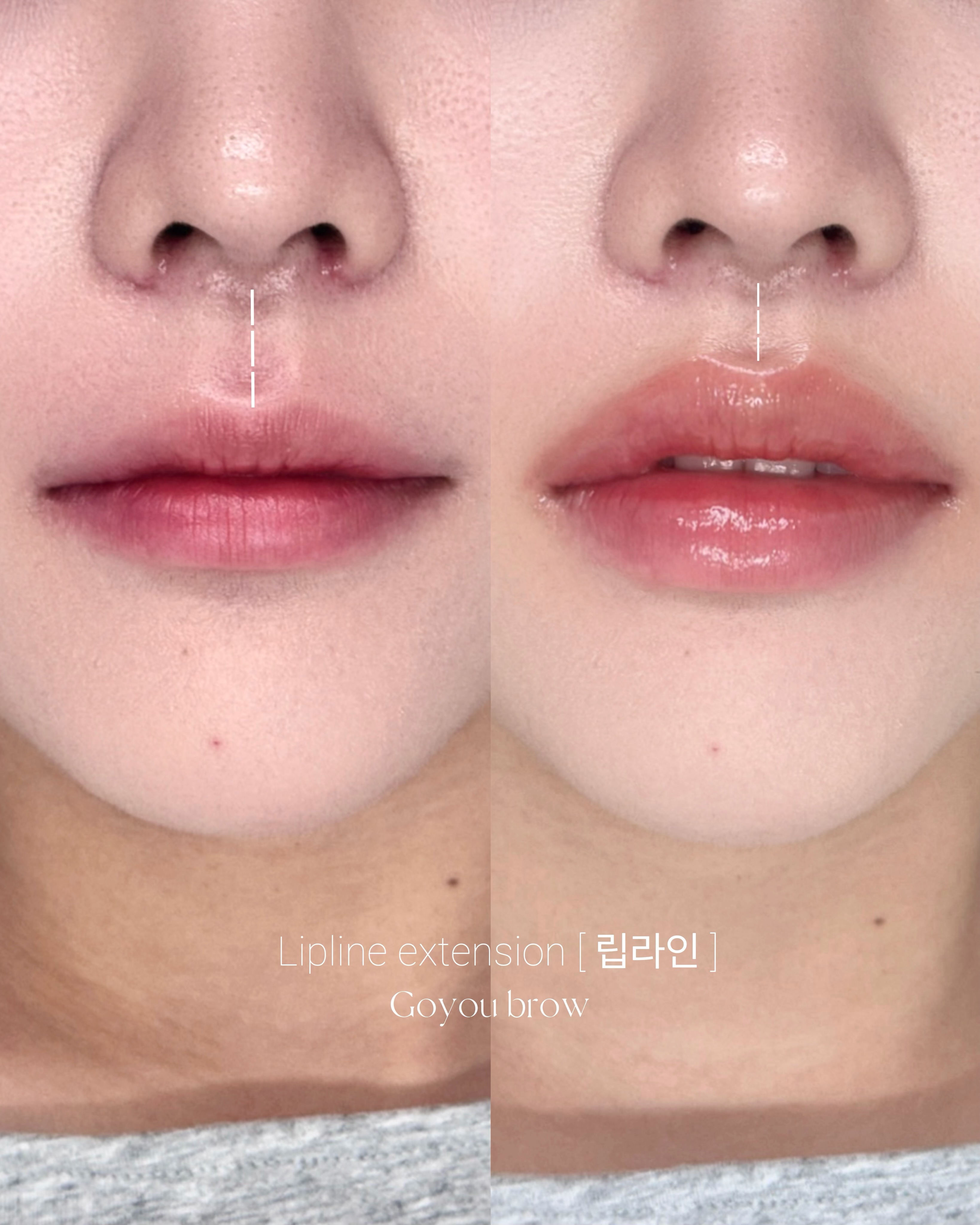 Microblading and Lip Blush Enhance Fullness in Seoul