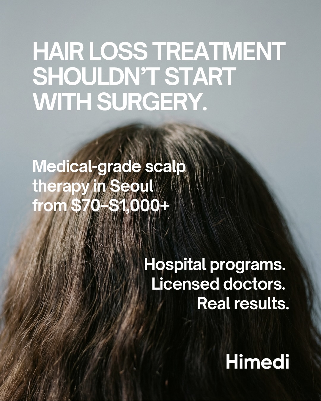Seoul Clinics Offer Non-Surgical Hair Loss Treatments