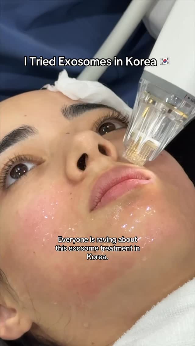 Exosomes and RF Microneedling Skincare Treatments