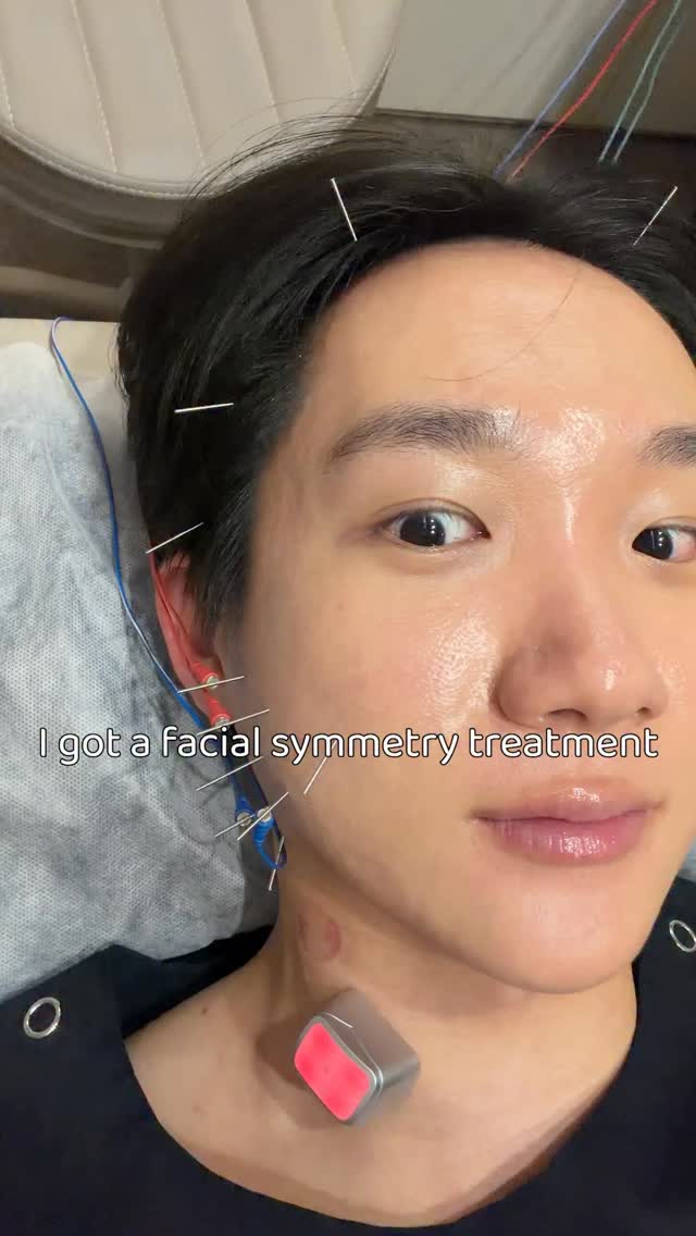 Holistic Facial Symmetry Treatment At Duna Clinic