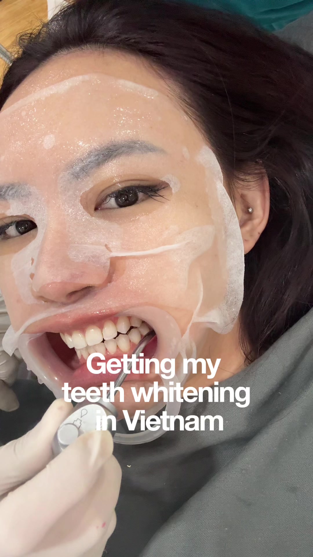 Dental Clinic Offers Teeth Whitening and Cleaning
