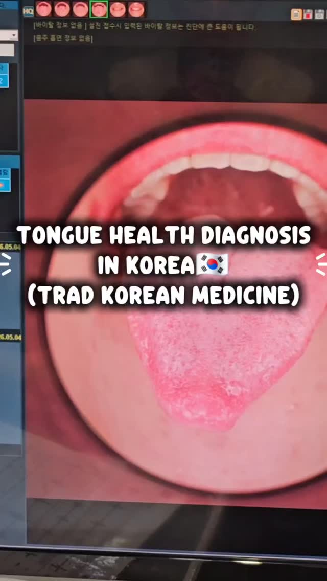 Korean Medicine Clinic Assesses Stress and Fatigue
