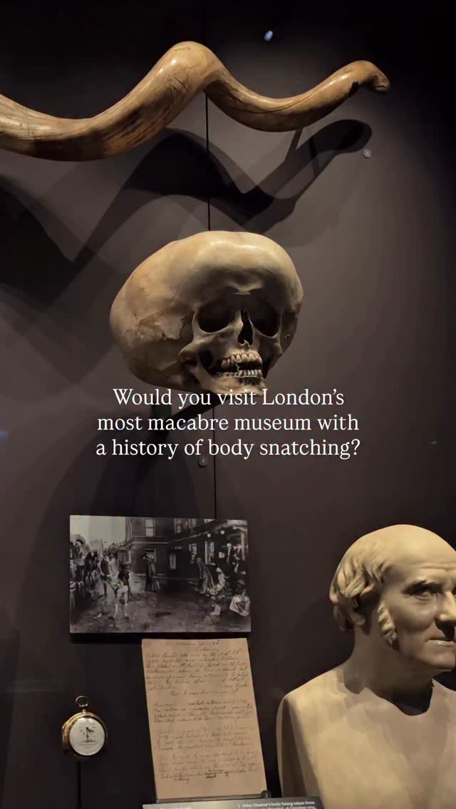 London's Hunterian Museum: Medical History and Specimens