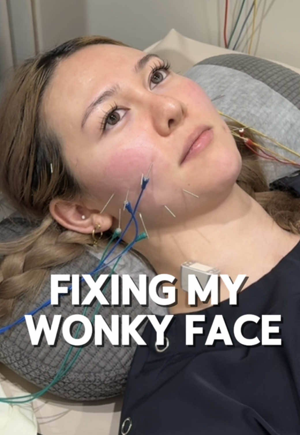 Korean Clinic Offers Facial Symmetry Treatment