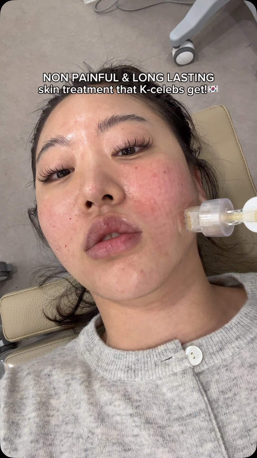 GU Clinic Offers Exosome Skin Treatment