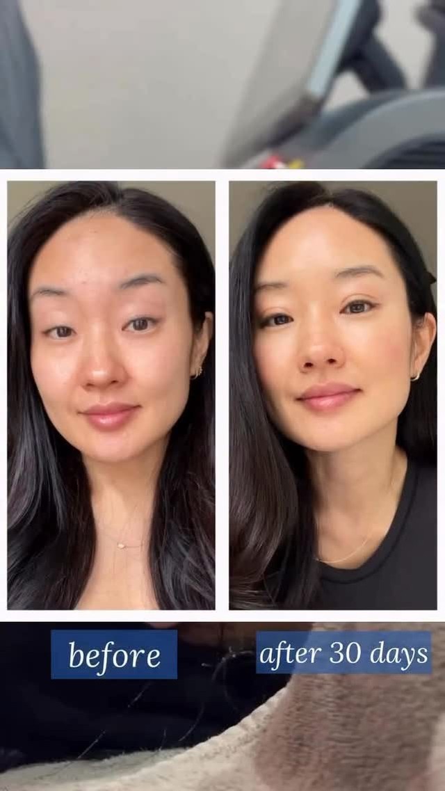 Korean Clinic Offers Facial Lifting Treatments