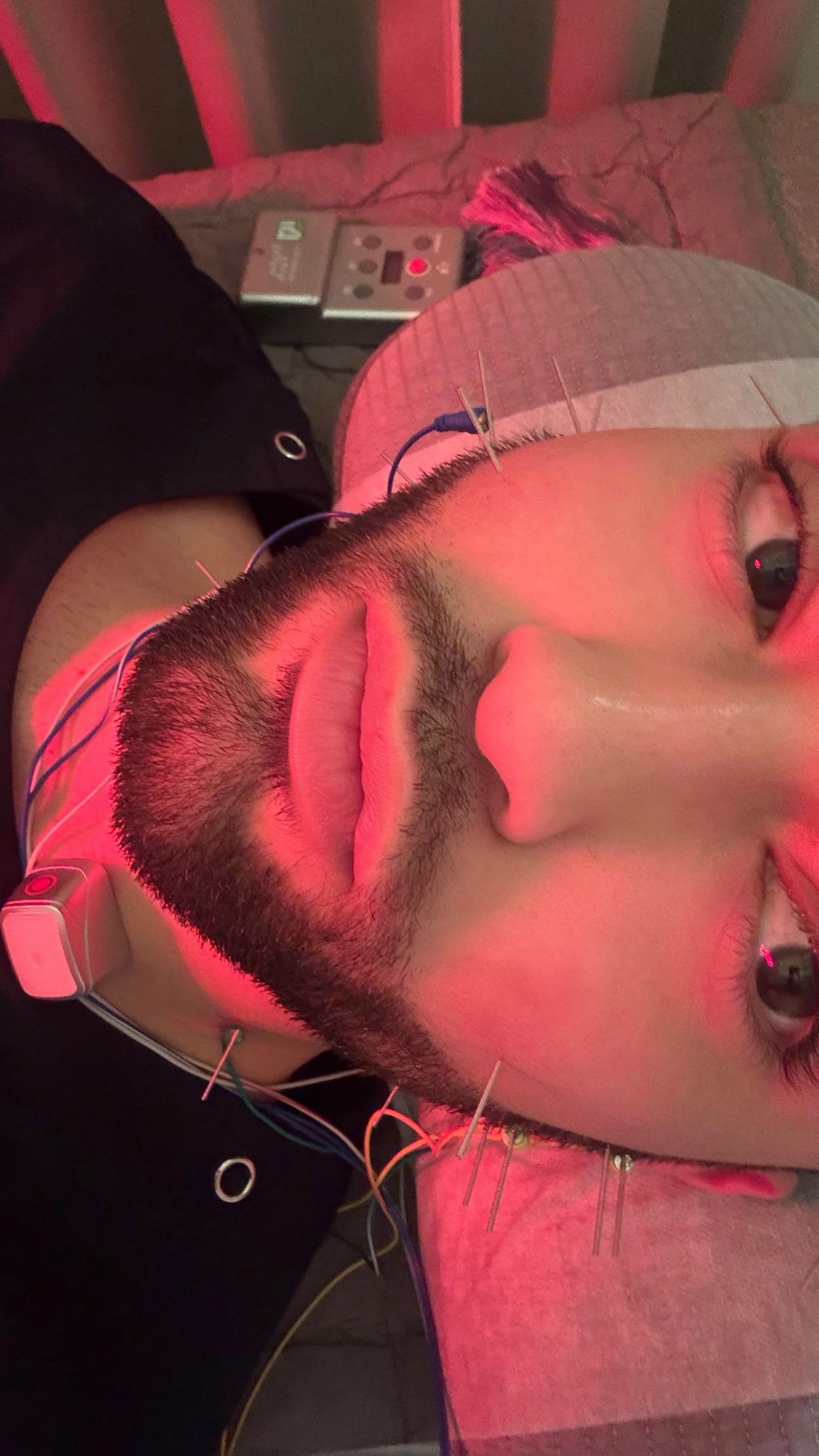 Duna Korean Medicine Facial Symmetry Treatment