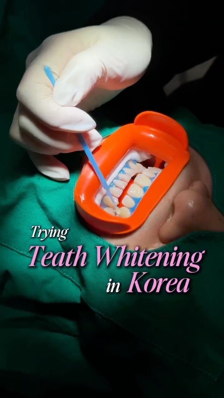 Korean Dental Clinic Offers Affordable Teeth Whitening