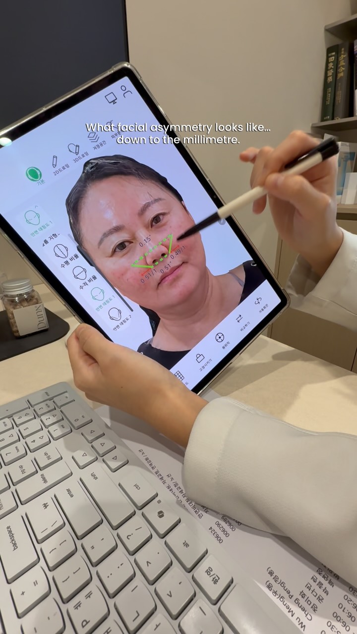 Korean Medicine Clinic Addresses Facial Asymmetry