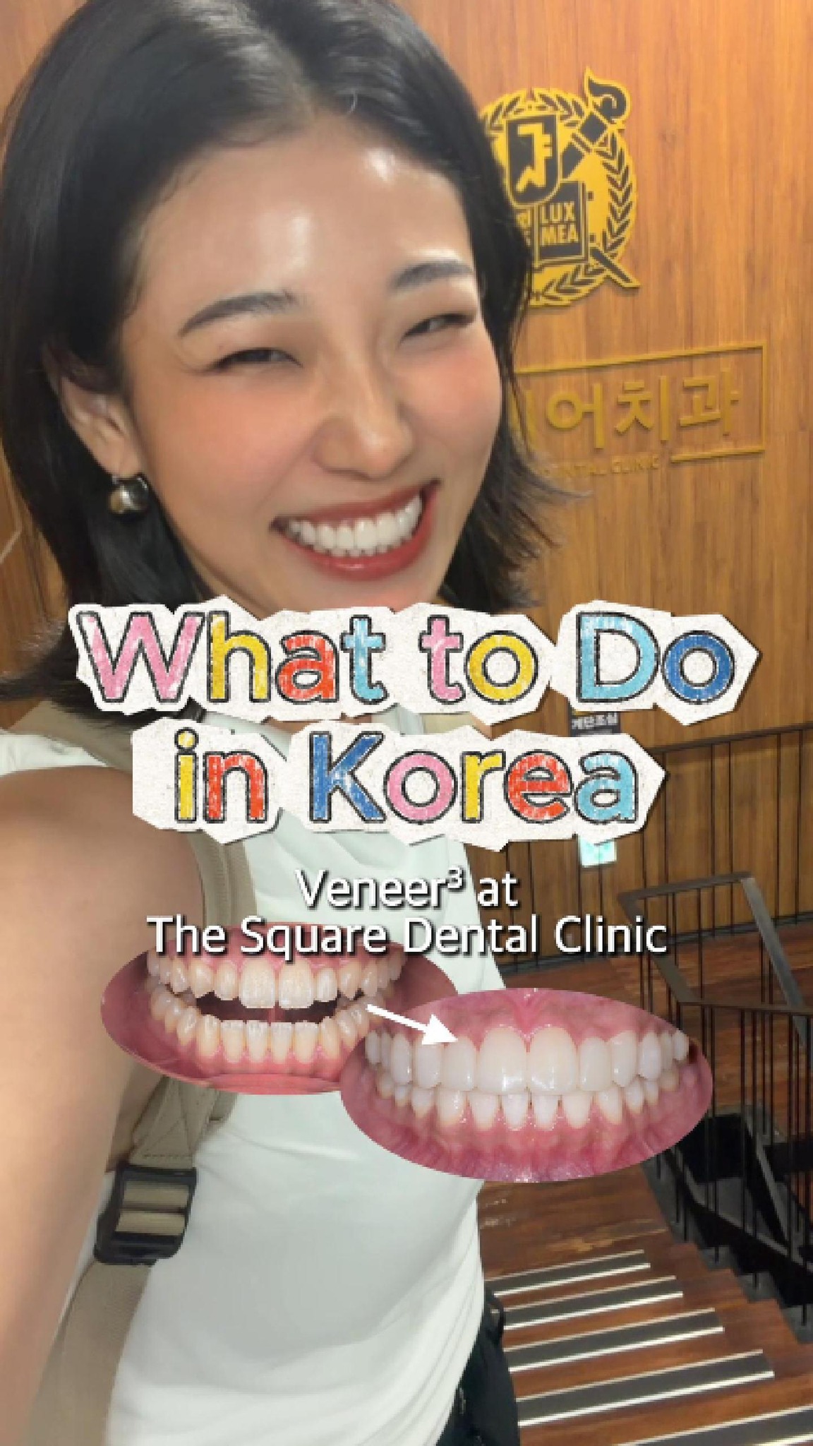 Dental Veneers and Whitening at Korean Clinic