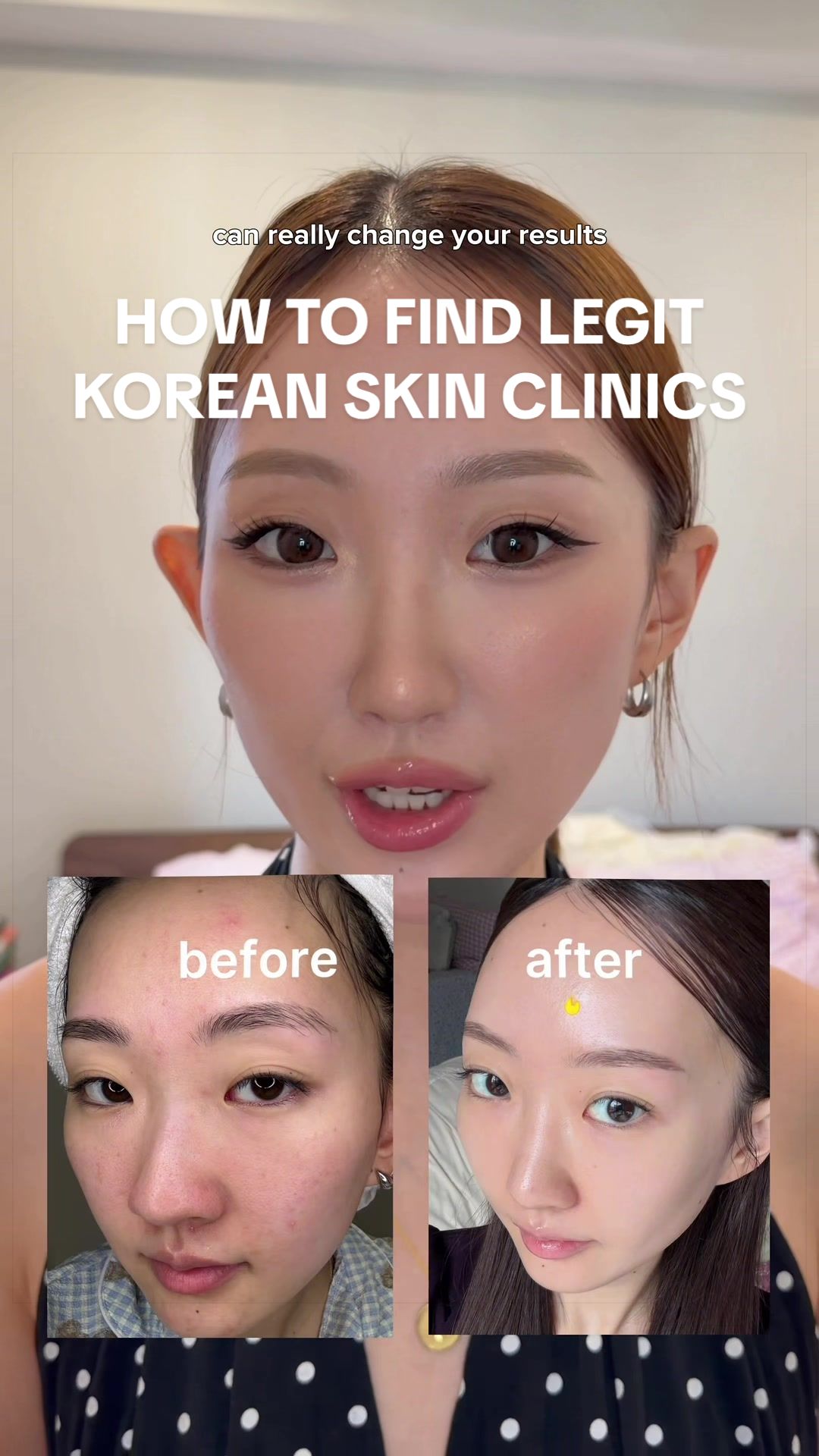 Korean Skin Clinics Offer Personalized Treatments