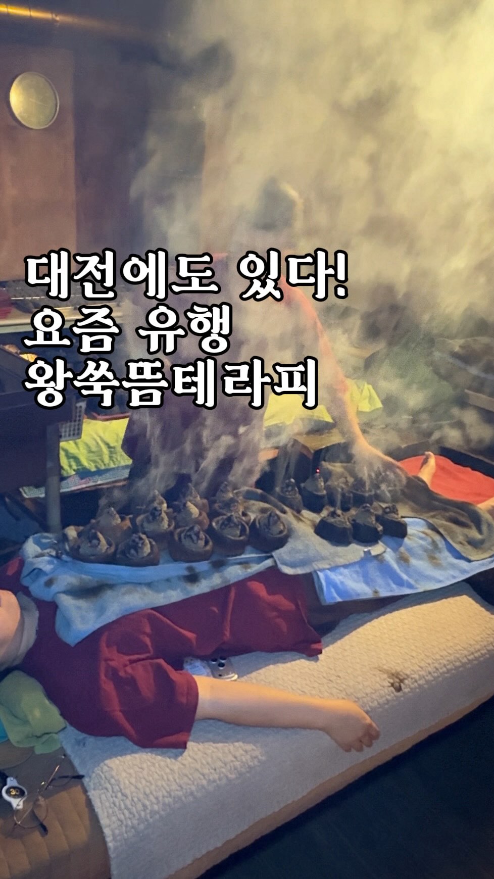 Mugwort Therapy Experience in Daejeon