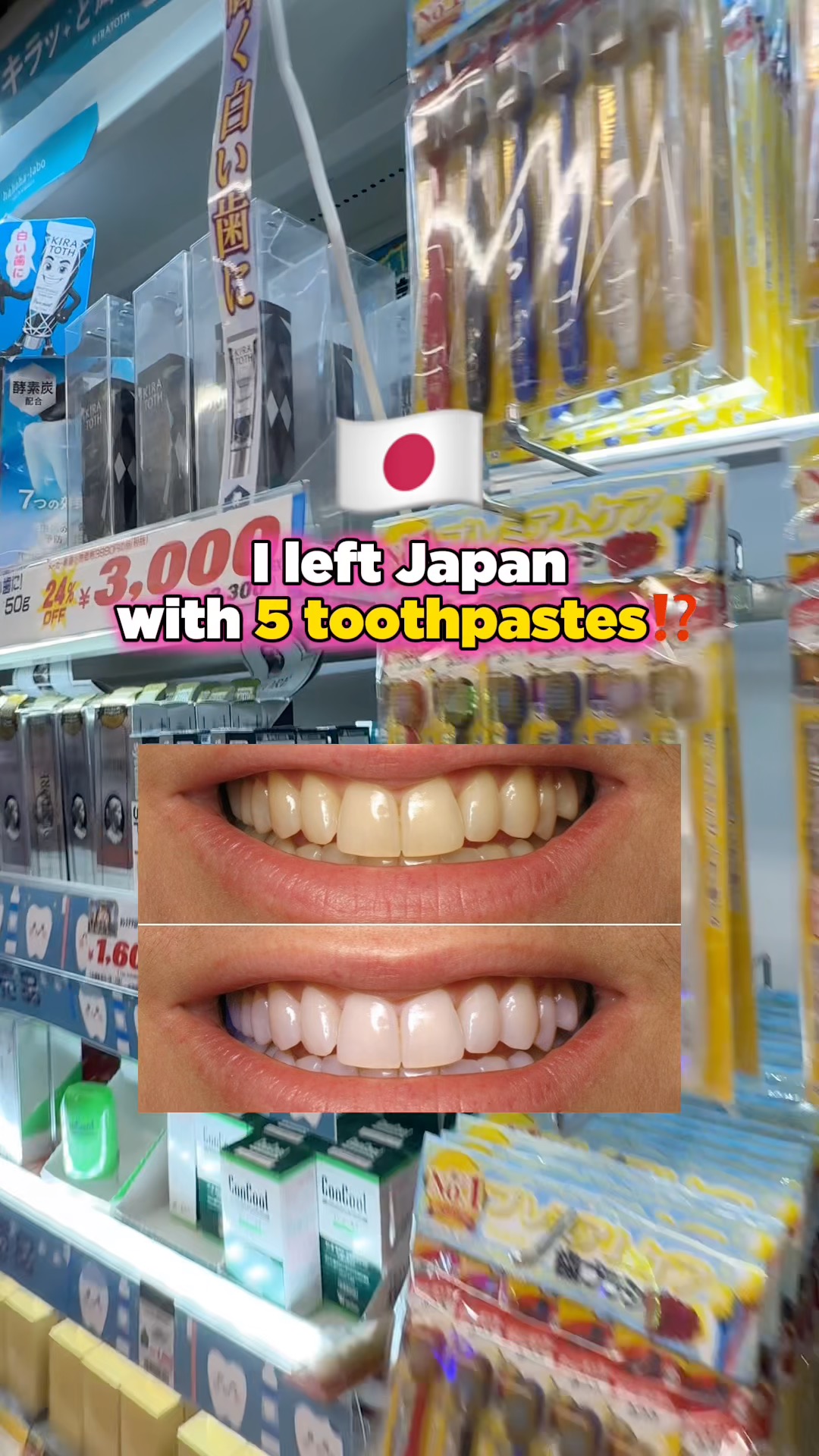 Don Quijote Tooth Whitening Gel Viral Video