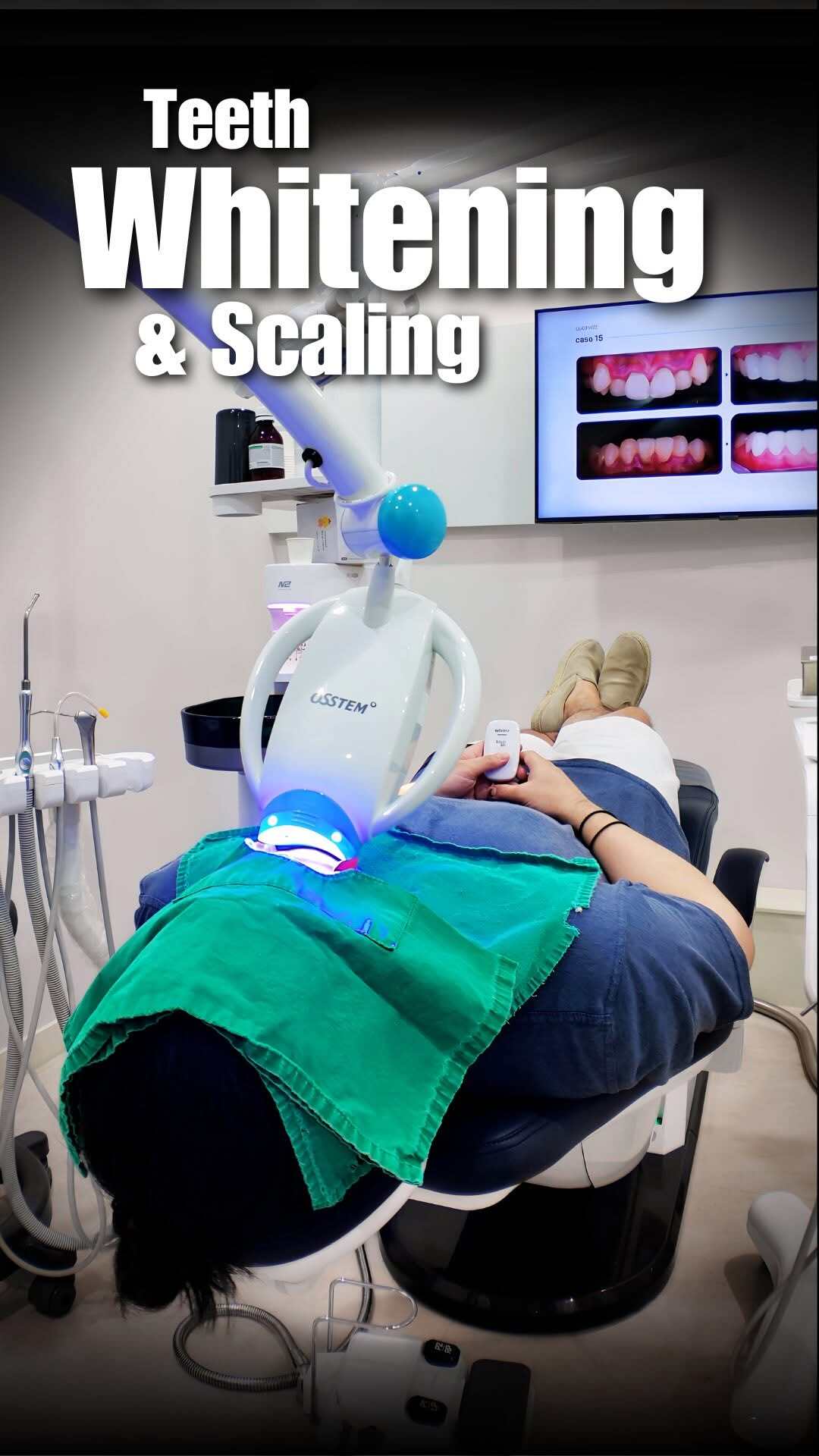 Premium Dental Clinic in Gangnam Offers Teeth Whitening
