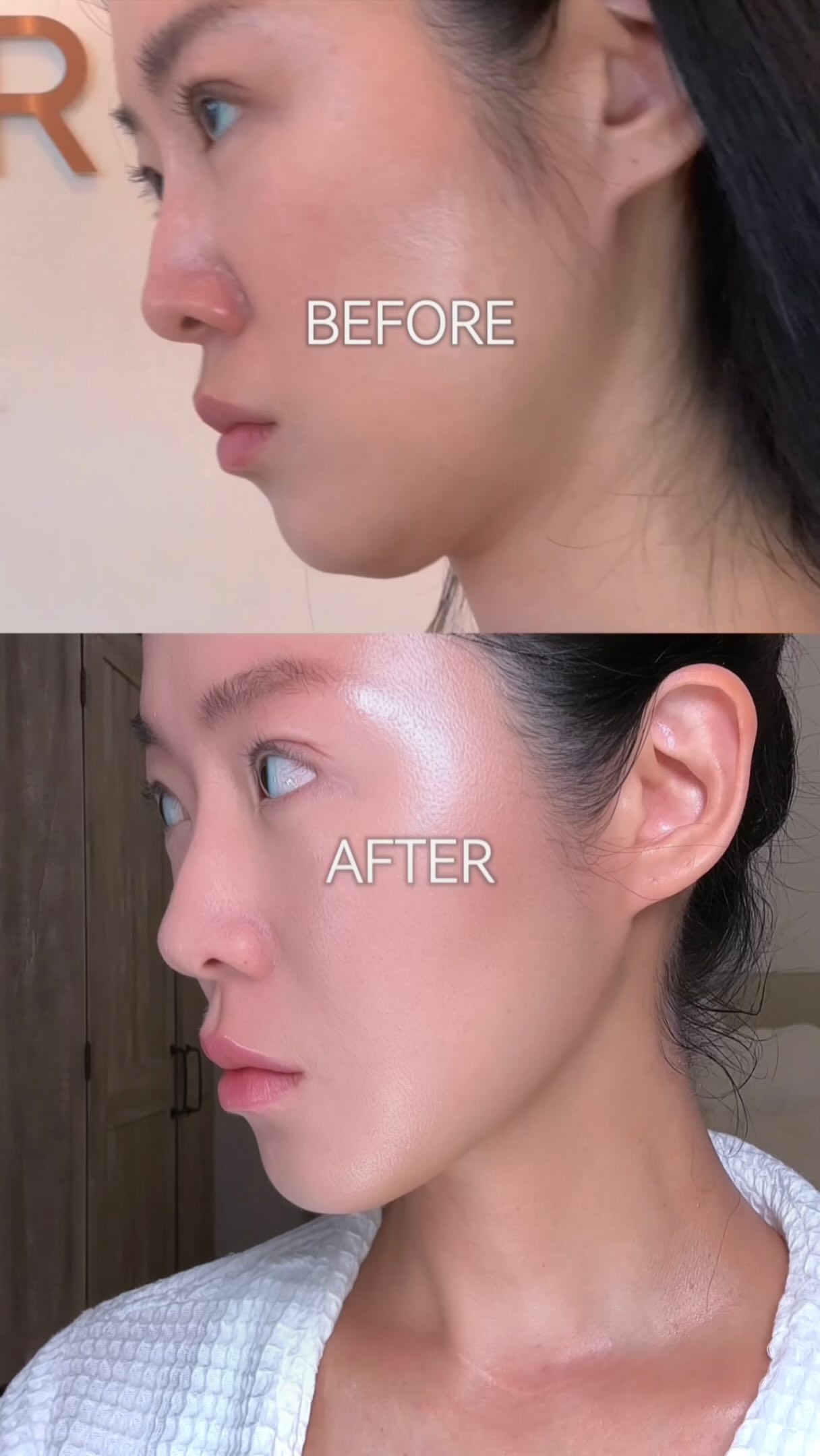 Gangnam Clinic Offers Advanced Non-Surgical Treatments