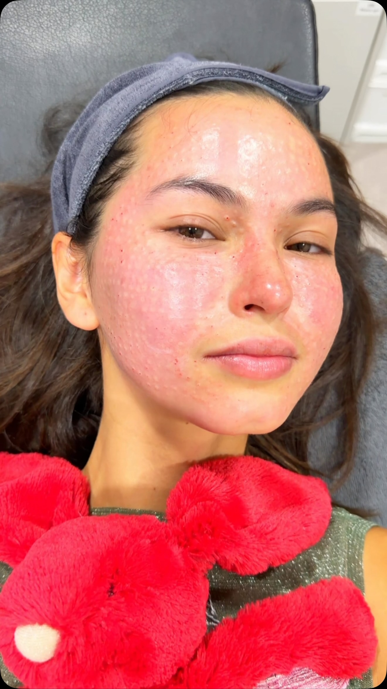 Korean Skincare Treatment Experience At Nue Clinic