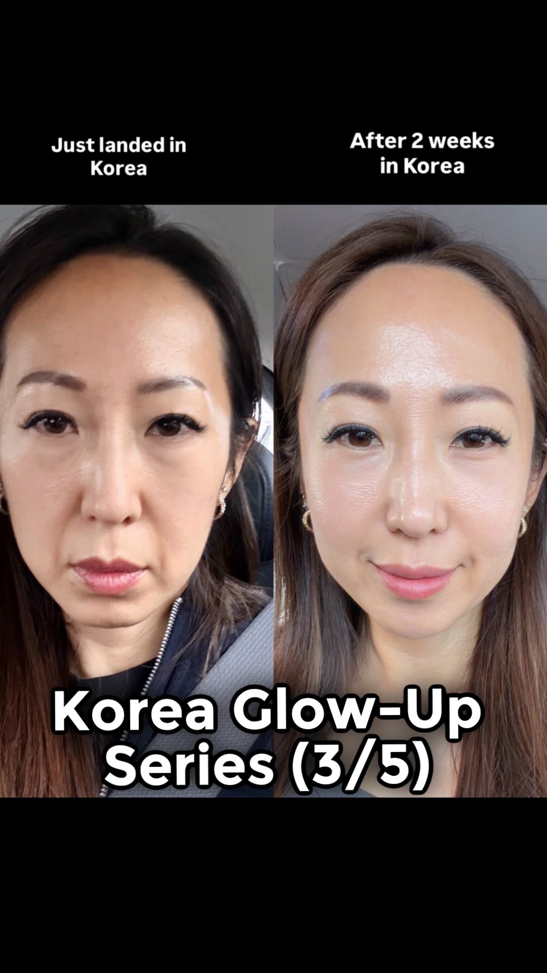 Facial and Posture Correction Clinic Session