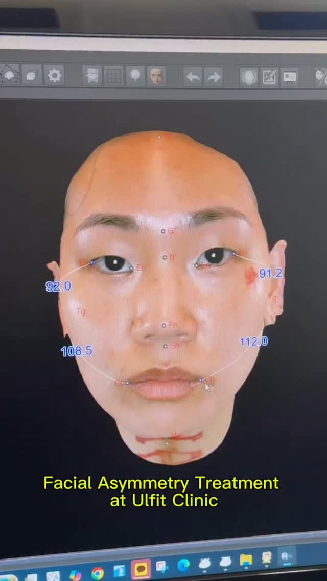 Korean Medicine Clinic Focuses on Facial Symmetry