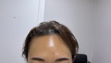 Meifill Clinic and Gangnam Area's Beauty Services
